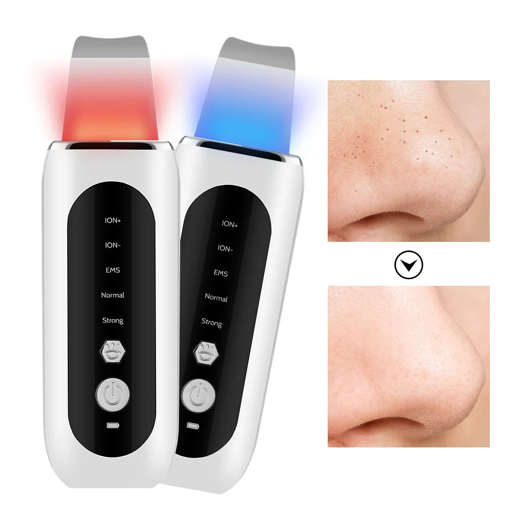Ultrasonic Skin Scrubber 5 Modes