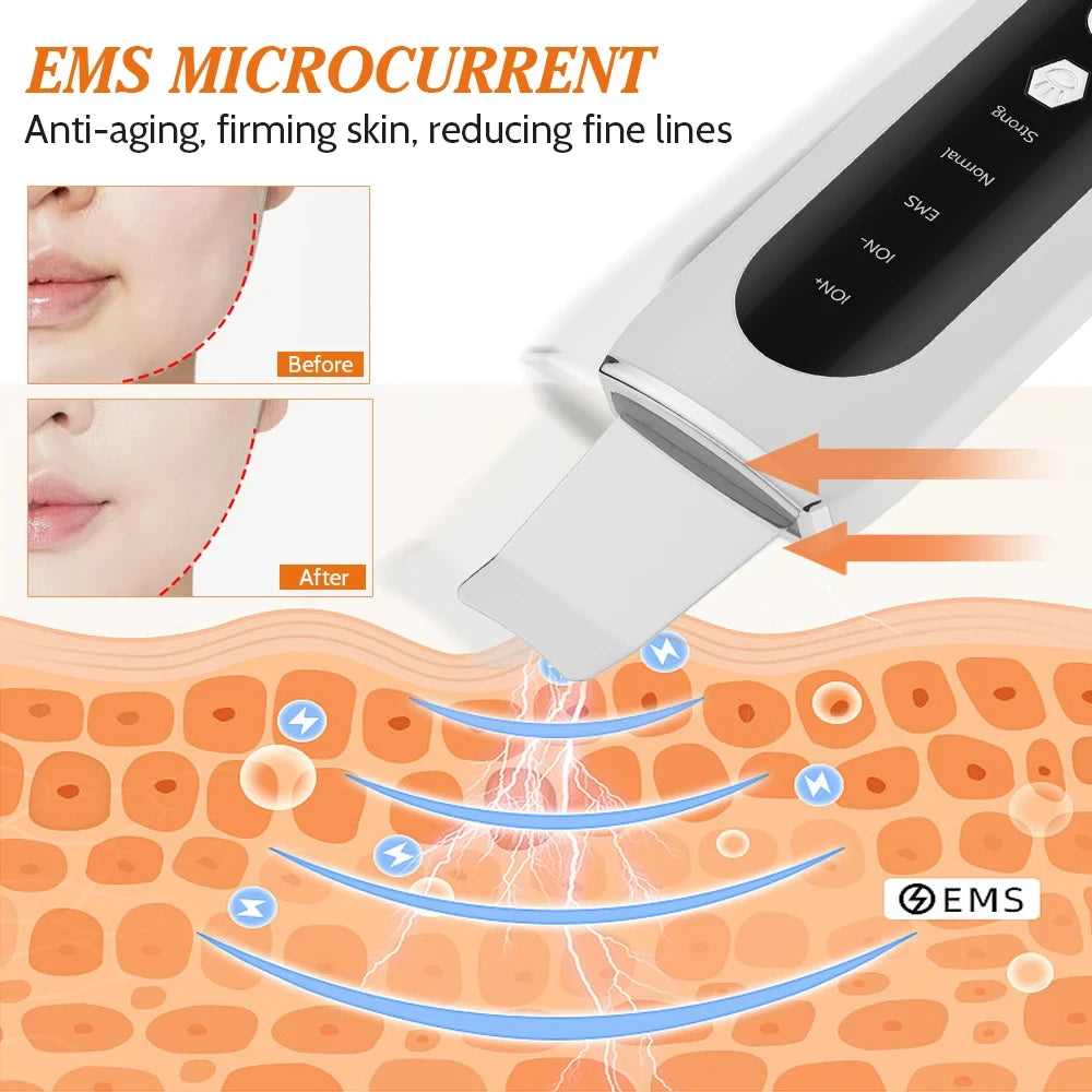 Ultrasonic Skin Scrubber 5 Modes